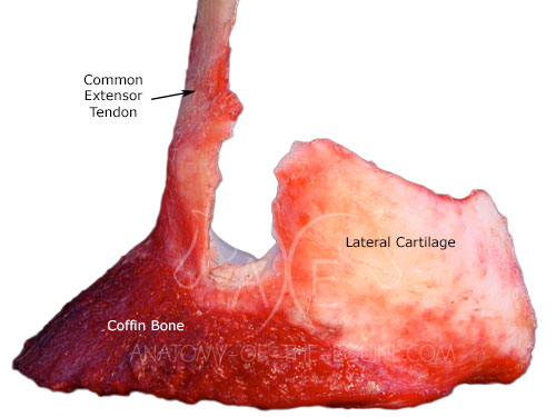 Only the common extensor tendon and lateral cartilage remains on the coffin bone