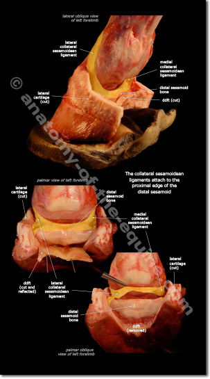 collateral sesamoidean ligament