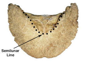 It is clear to see where the deep digital flexor tendon will attach.